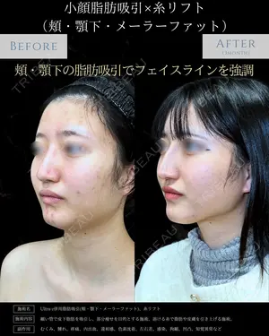 null days after image