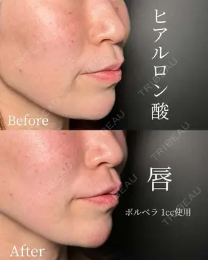 null days after image