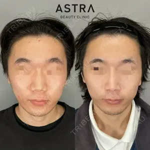 270 days after image