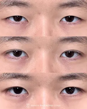 null days after image