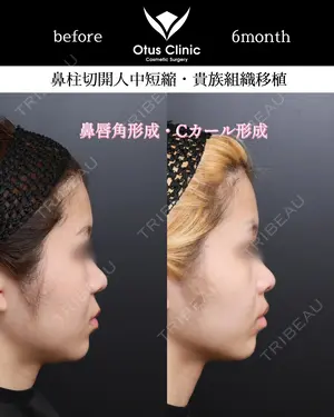 180 days after image