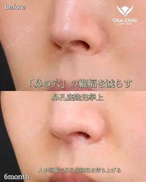 180 days after image