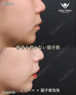 180 days after image