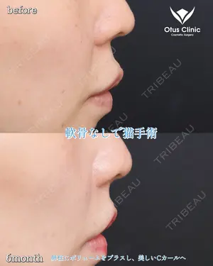 180 days after image