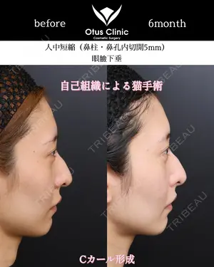 180 days after image