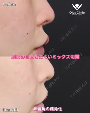 180 days after image