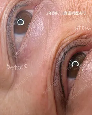 730 days after image