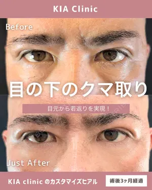 null days after image