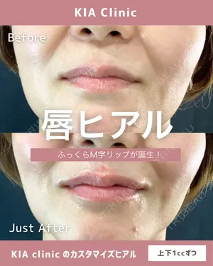 null days after image