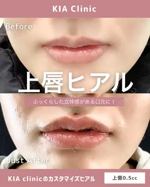 null days after image