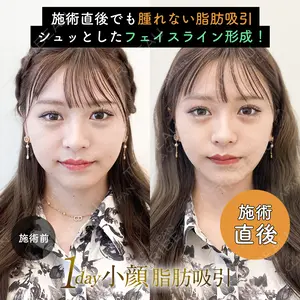 null days after image