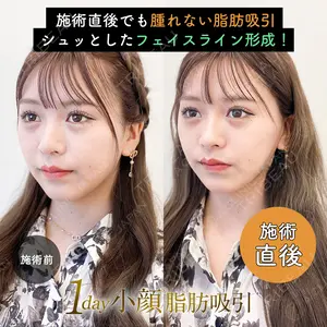 null days after image