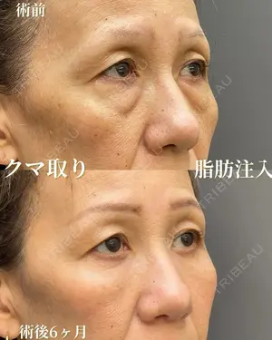 180 days after image