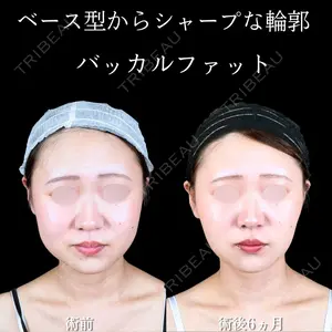 180 days after image