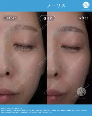 null days after image