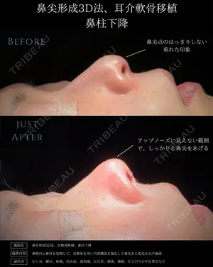 null days after image