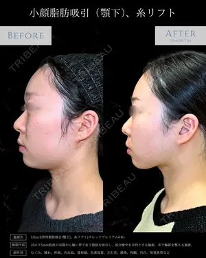 null days after image