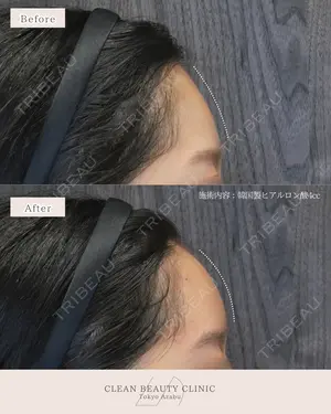 before image
