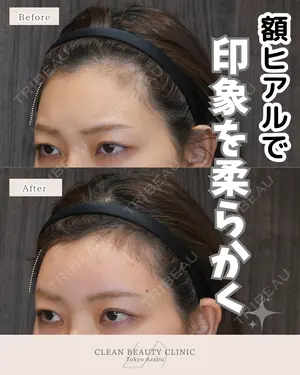 null days after image