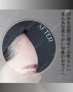 null days after image