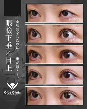 180 days after image