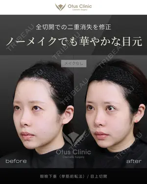 120 days after image