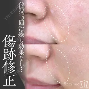 null days after image