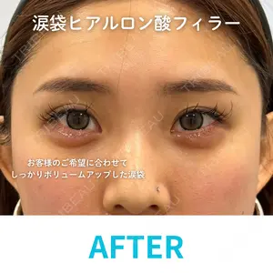 null days after image