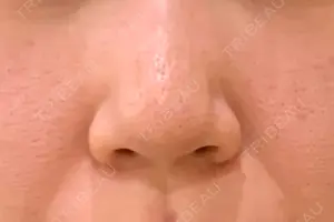 null days after image