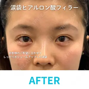 null days after image