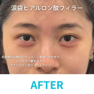 null days after image