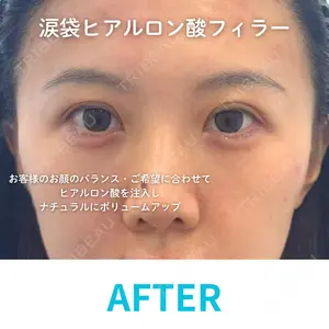 null days after image