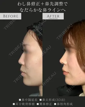 30 days after image