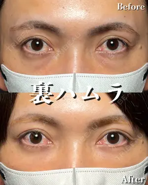 before image