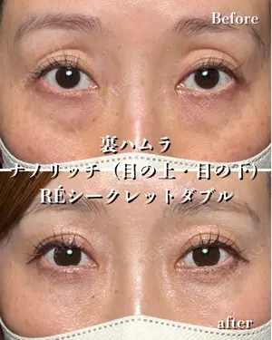 before image
