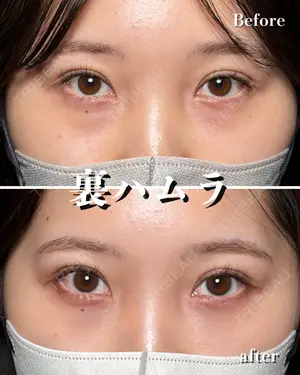 30 days after image