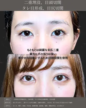 null days after image