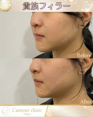 null days after image