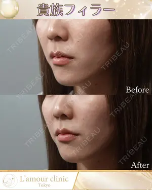 null days after image