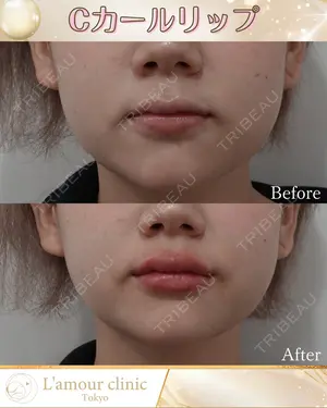 null days after image