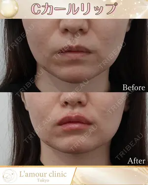 null days after image