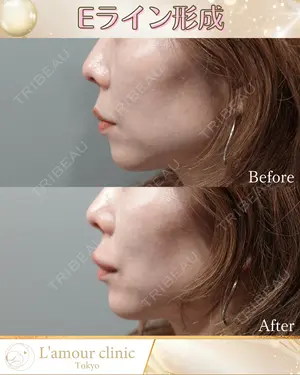 null days after image