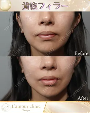 null days after image