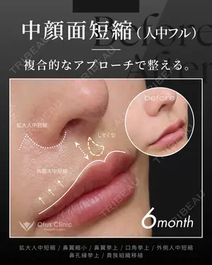 180 days after image