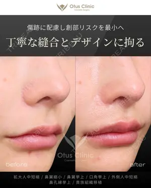 180 days after image