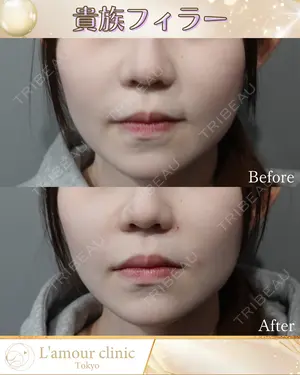 null days after image