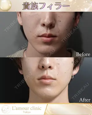 null days after image