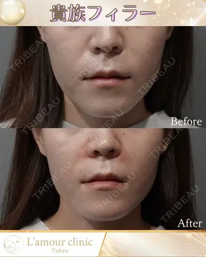 null days after image