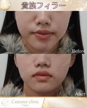 null days after image