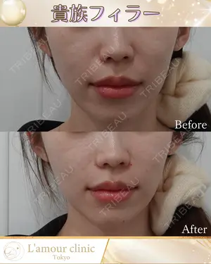 null days after image